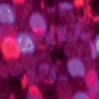 Cerise/Glow White Purple