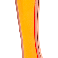 Flame Jelly/Copper Base